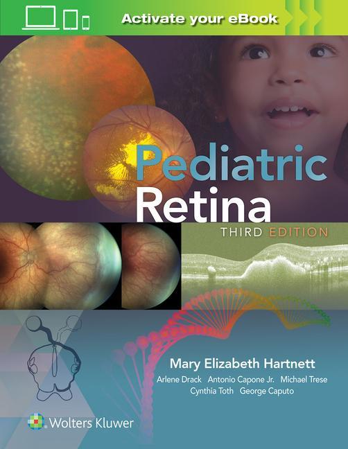 Book Pediatric Retina Mary Elizabeth Hartnett