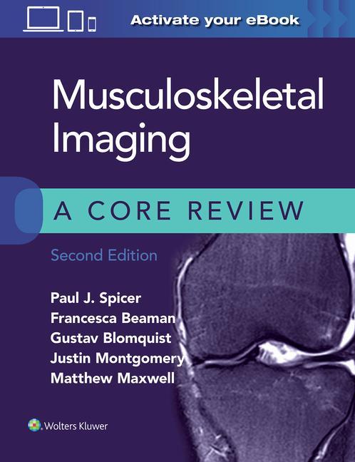 Könyv Musculoskeletal Imaging: A Core Review 