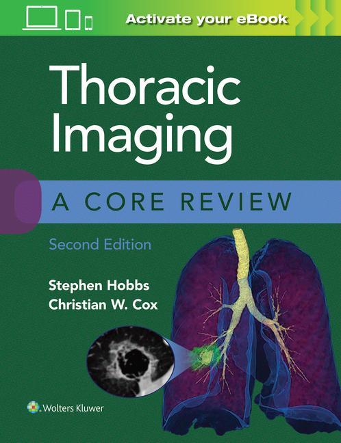 Knjiga Thoracic Imaging: A Core Review 