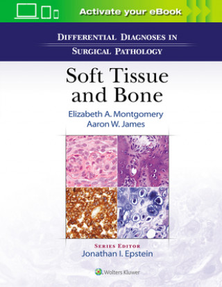 Kniha Differential Diagnoses in Surgical Pathology: Soft Tissue and Bone Elizabeth A. Montgomery