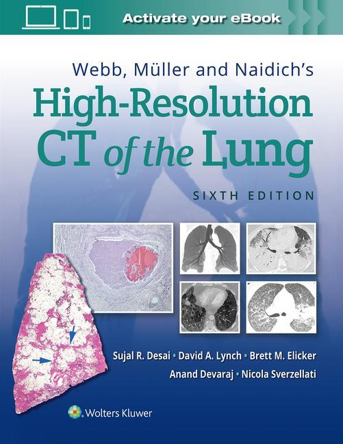 Книга Webb, Muller and Naidich's High-Resolution CT of the Lung 