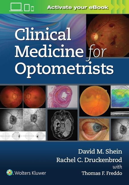 Carte Clinical Medicine for Optometrists 