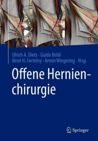 Knjiga Offene Hernienchirurgie Ulrich A. Dietz