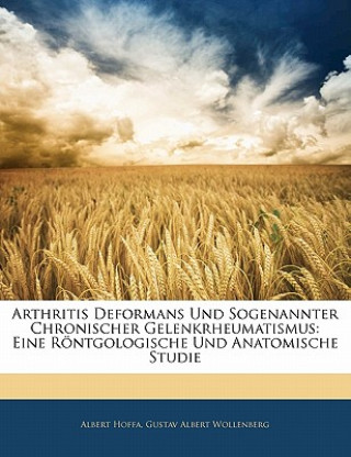 Kniha Arthritis Deformans Und Sogenannter Chronischer Gelenkrheumatismus: Eine Rontgologische Und Anatomische Studie Albert Hoffa