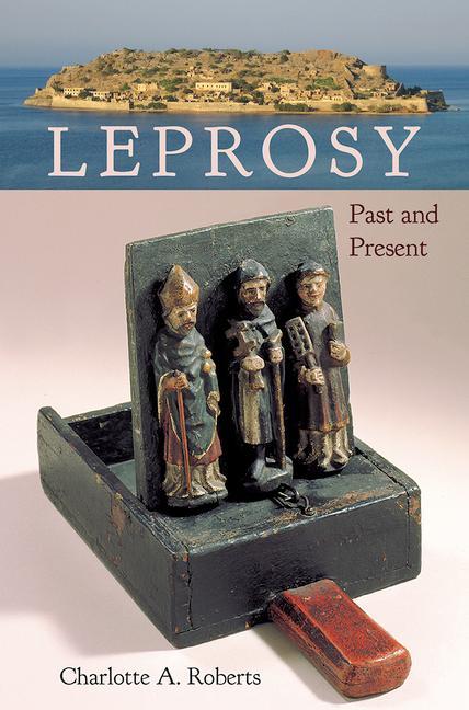 Книга Leprosy Charlotte A. Roberts