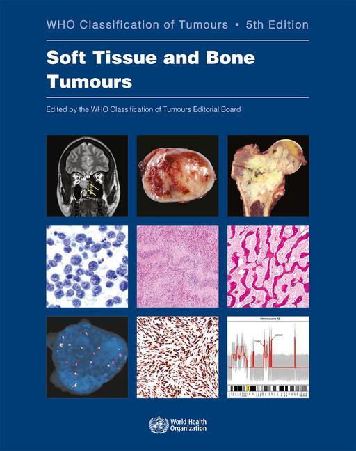Книга WHO classification of tumours of soft tissue and bone tumours 