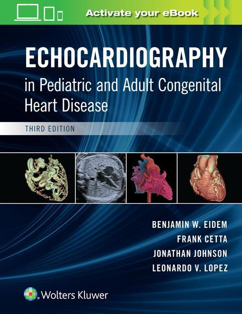 Kniha Echocardiography in Pediatric and Adult Congenital Heart Disease Benjamin Eidem