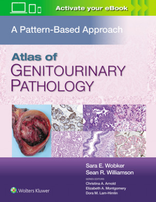 Книга Atlas of Genitourinary Pathology Sara Wobker