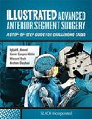 Könyv Illustrated Advanced Anterior Segment Surgery I. Ahmed