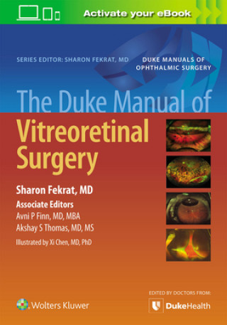 Carte Duke Manual of Vitreoretinal Surgery Sharon Fekrat