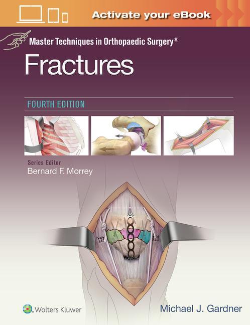 Книга Master Techniques in Orthopaedic Surgery: Fractures Michael Gardner