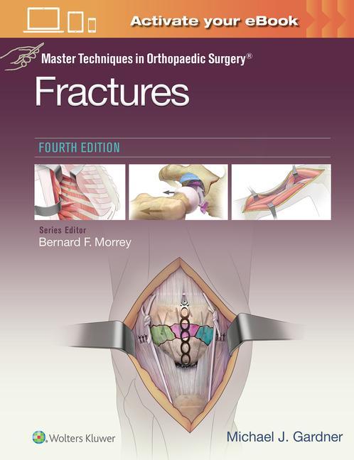 Kniha Master Techniques in Orthopaedic Surgery: Fractures Michael Gardner