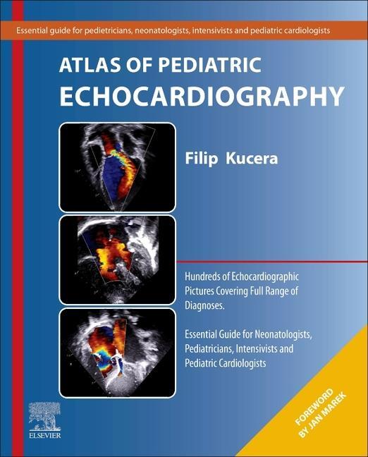 Knjiga Atlas of Pediatric Echocardiography 