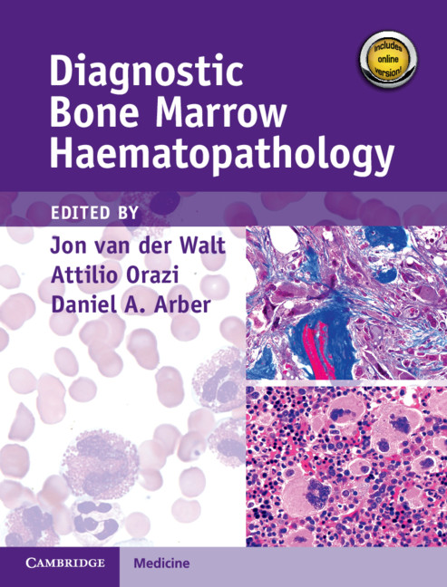 Könyv Diagnostic Bone Marrow Haematopathology Book with Online content JON VAN DER WALT