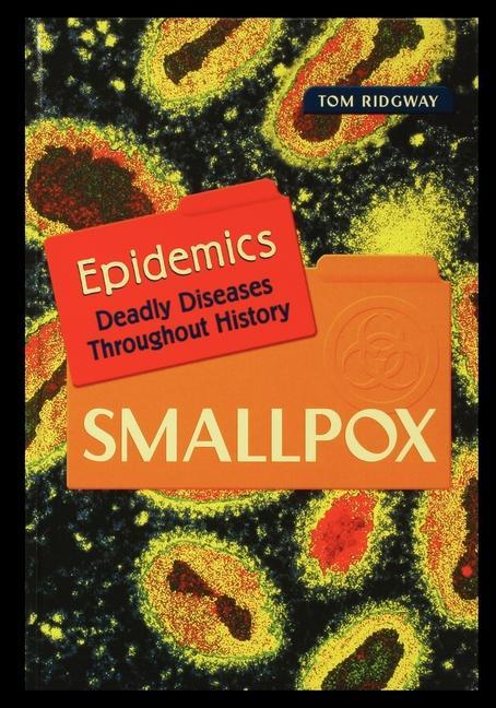 Knjiga Smallpox Tom Ridgway