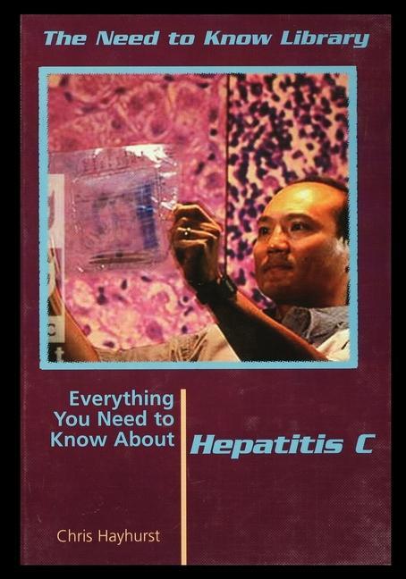 Buch Hepatitis C Chris Hayhurst