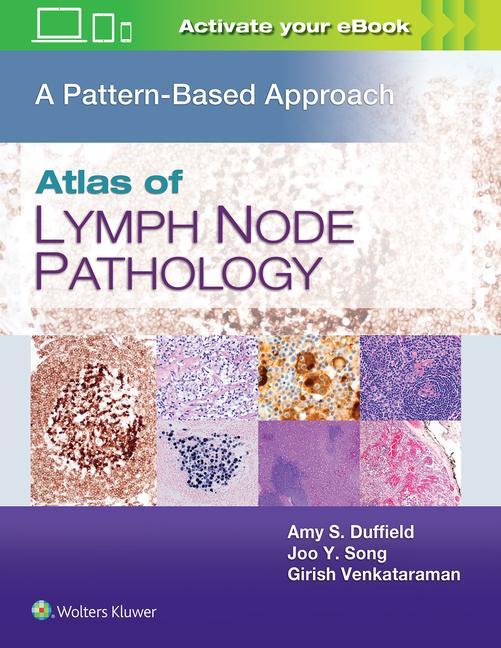 Carte Atlas of Lymph Node Pathology Amy S. Duffield