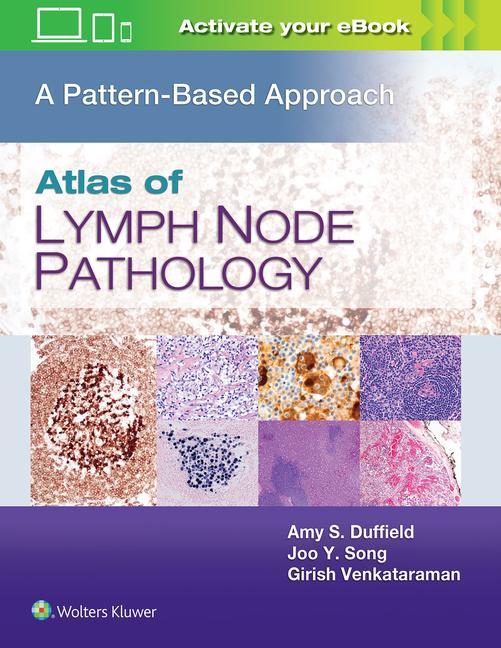 Boek Atlas of Lymph Node Pathology Amy S. Duffield