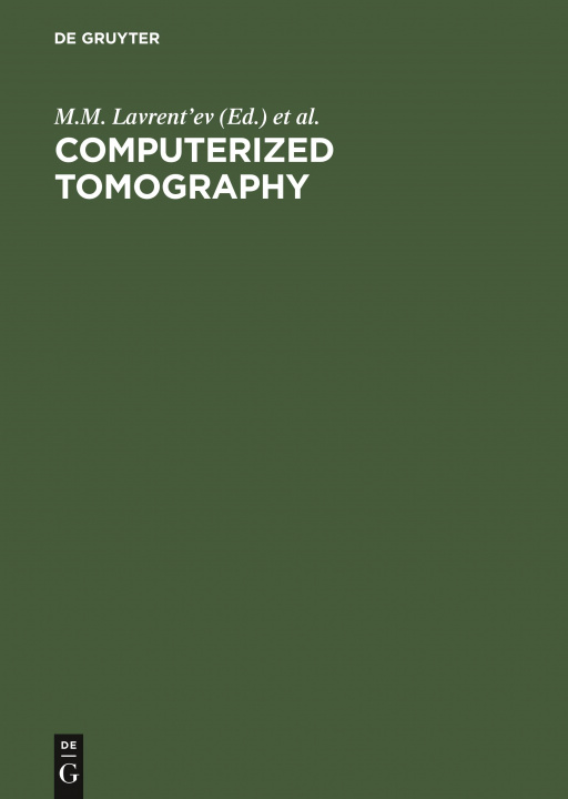 Knjiga Computerized Tomography No Contributor
