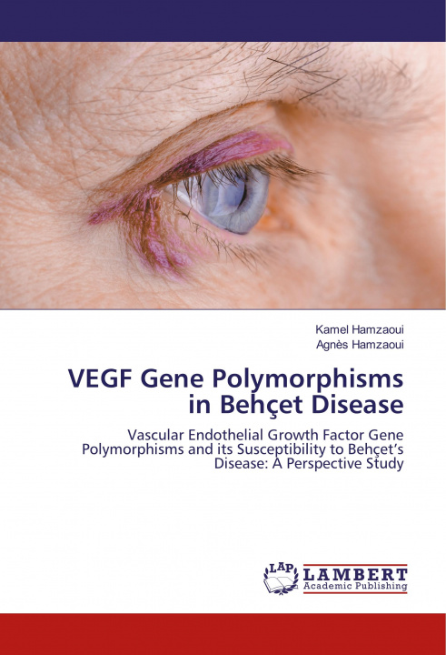 Книга VEGF Gene Polymorphisms in Behcet Disease Agn?s Hamzaoui