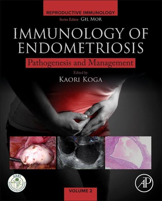 Kniha Immunology of Endometriosis 