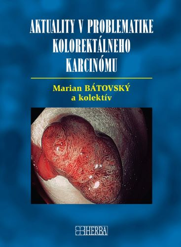 Kniha Aktuality v problematike kolorektálneho karcinómu Marian Bátovský