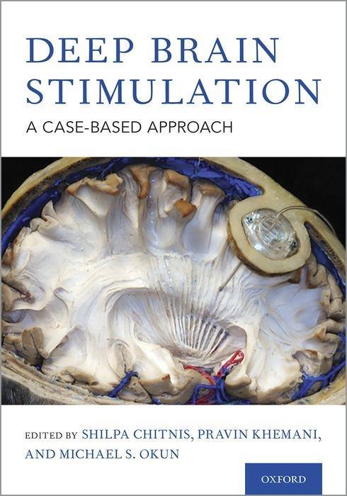 Kniha Deep Brain Stimulation 