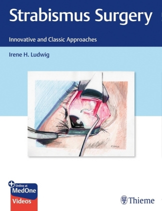 Kniha Strabismus Surgery 