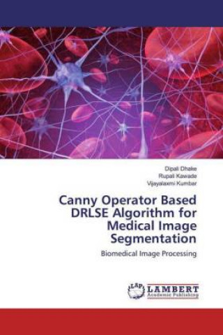 Book Canny Operator Based DRLSE Algorithm for Medical Image Segmentation Rupali Kawade