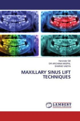 Książka Maxillary Sinus Lift Techniques Dr Archana Nagpal