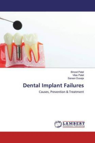 Kniha Dental Implant Failures Vilas Patel