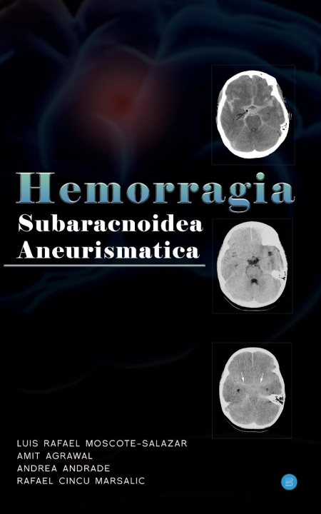 Buch Hemorragia Subaracnoidea Aneurismatica Amit Agrawal