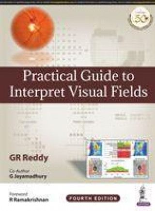 Kniha Practical Guide to Interpret Visual Fields 