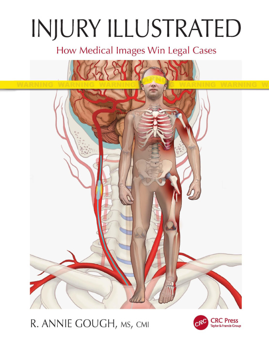 Βιβλίο Injury Illustrated R. Annie Gough