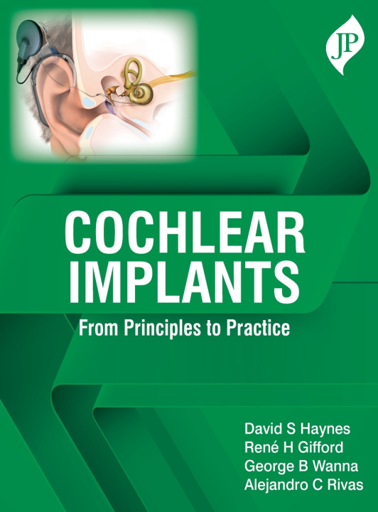 Knjiga Cochlear Implants David S Haynes