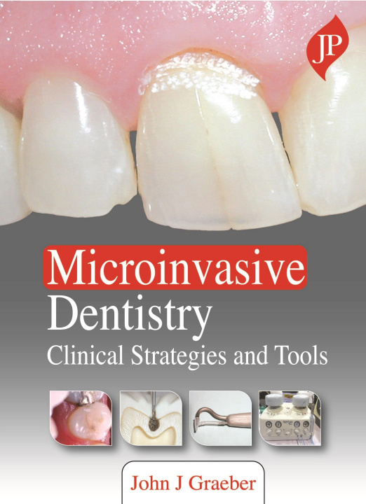 Книга Microinvasive Dentistry John J Graeber
