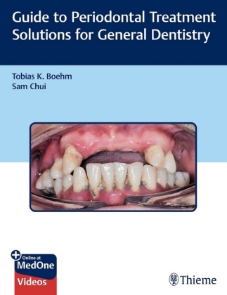 Kniha Guide to Periodontal Treatment Solutions for General Dentistry Sam Chui