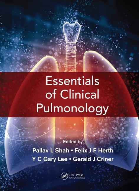 Könyv Essentials of Clinical Pulmonology 