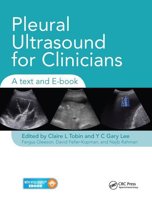 Книга Pleural Ultrasound for Clinicians 