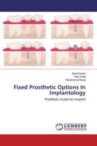 Könyv Fixed Prosthetic Options In Implantology Vilas Patel