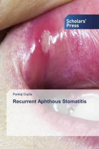 Kniha Recurrent Aphthous Stomatitis 