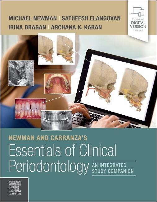 Kniha Newman and Carranza's Essentials of Clinical Periodontology 