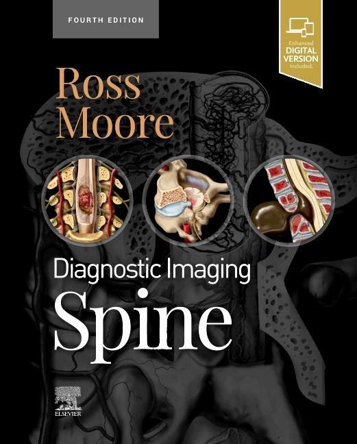 Kniha Diagnostic Imaging: Spine Kevin R. Moore