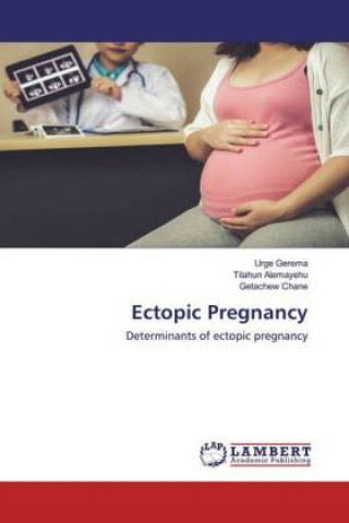 Knjiga Ectopic Pregnancy Tilahun Alemayehu