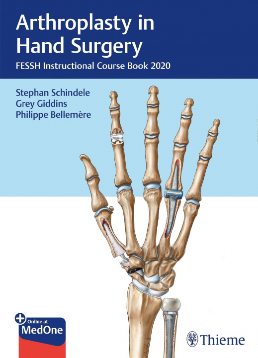 Book Arthroplasty in Hand Surgery Grey Giddins