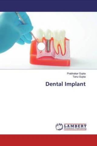 Knjiga Dental Implant Tanu Gupta
