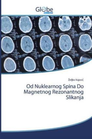 Kniha Od Nuklearnog Spina Do Magnetnog Rezonantnog Slikanja 