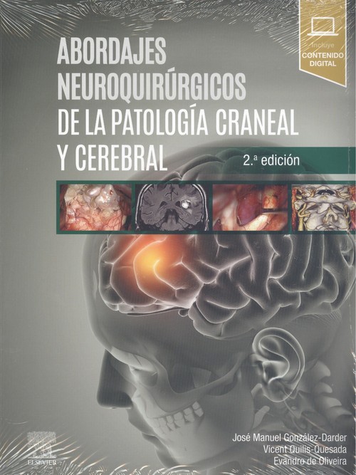 Könyv ABORDAJES NEUROQUIRÚRGICOS DE LA PATOLOGÍA CRANEAL Y CEREBRAL JOSE MANUEL GONZALEZ-DARDER