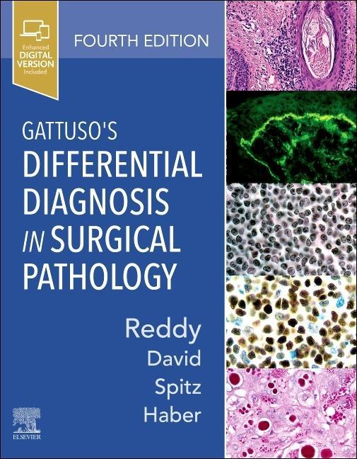 Książka Gattuso's Differential Diagnosis in Surgical Pathology Vijaya B. Reddy