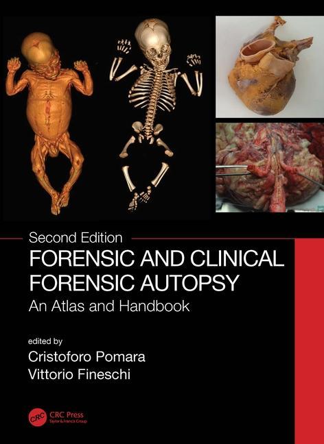 Knjiga Forensic and Clinical Forensic Autopsy 